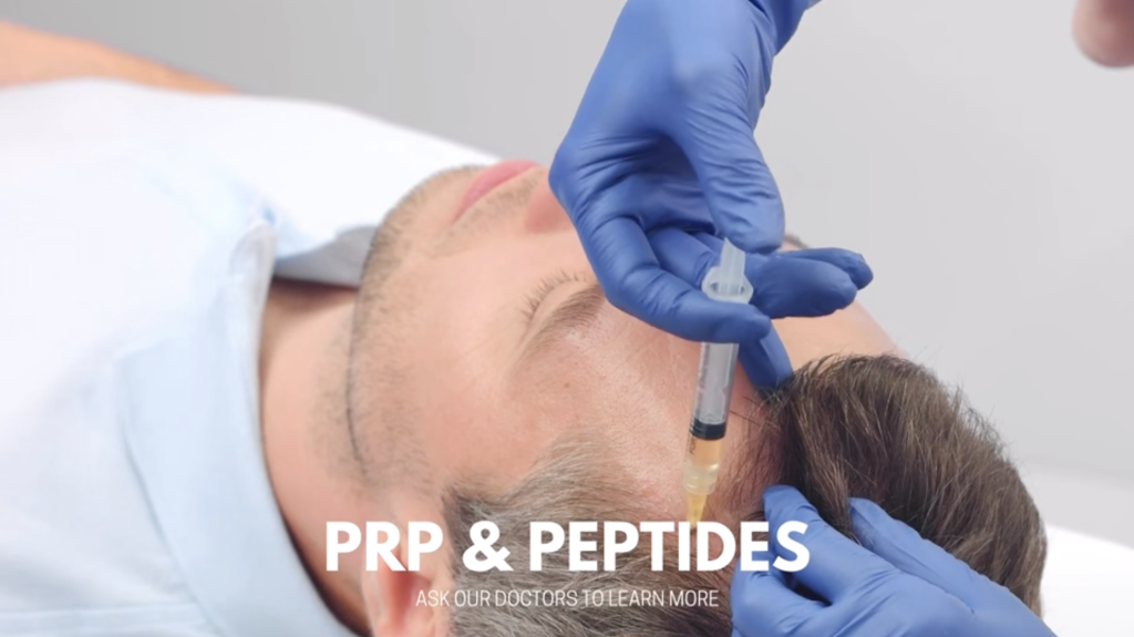 PRP for Hair Loss